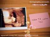 سونوگرافی جنین در ۲۵ هفته