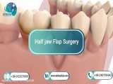 Half jaw Flap Surgery in atrina