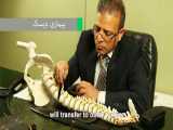 توضیحات دکتر محمد ابراهیم طاهریان در مورد بیماری دیسک