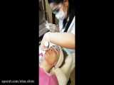 هیدرودرمی آبرسانی، پاکسازی و جوانسازی پوست صورت و گردن در کلینیک السا