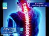 دیسک گردن ، راه های تشخیص و درمان آن