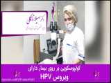 کولپوسکوپی برای تشخیص HPV