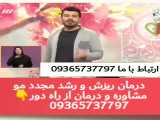 کم کاری تیروئید و ارتباط مستقیم آن با ریزش مو