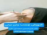 آموزش چسب زدن بینی دکتر محمدی مفرد(09215256755)