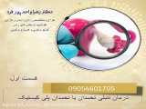 درمان تنبلی تخمدان_تخمدان پلی کیستیک