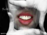لمینت دندان | لبخند زیبا ساختنیست | دکتر علی تمدن