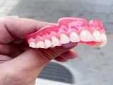 دست دندان پروتز متحرک پارسیل اکریلی کروم کبالت دندانسازی
