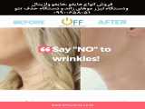 hifutherapy HIFU Therapy: High Intensity Focused Ultrasounds « ultras