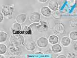 نانوذرات طلا چگونه سلول سرطانی را منفجر می کند؟ (شرکت نانو کاوشگران یکتای توس)