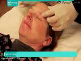 آموزش پاکسازی صورت | جوانسازی پوست | پاکسازی پوست (درمان با درمارولر)