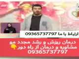 رفع قطعی ریزش مو در تلویزیون