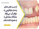 عوارض عدم جایگزینی دندان از دست رفته | دکتر سپیده دادگر