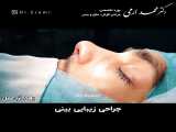 جراحی زیبایی بینی توسط دکتر محمد ارمی