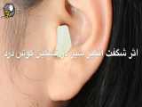 خواص درمانی شگفت انگیز سیر- از درمان گوش درد تا ...