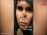 بریدن بینی زن افغان توسط شوهر بدبین+ فیلم دردناک که جهان را تکان داد