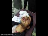 تصاویر دلخراش از زخمی های عزاداران حسینی در هند
