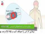 درمان خانگی و خوراکی ام اس با طب سنتی