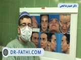 عمل ترمیمی بینی توسط دکتر حمید رضا فتحی فوق تخصص جراحی پلاستیک 
