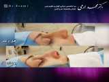 فیلم جراحی بینی | جراح بینی | دکتر محمد ارمی