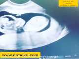 آیا سونوگرافی تعیین تاریخ بارداری جنسیت بچه را مشخص می‌کند؟