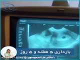 فیلم سونوگرافی بارداري ٥ هفته و ٥ روز