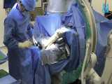 راهکارهای نیمه تهاجمی برای عمل های جراحی افراد دچار آسیب نخاعی