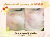 درمان جوش صورت و لکه های پوستی