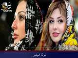 بازیگران زن ایرانی قبل و بعد از عمل جراحی زیبایی