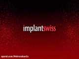 معرفی سیستم ایمپلنت سوئیس توسط جناب آقای دکتر حمیدرضا رجعتی( پروستودنتیست)