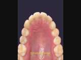 درمان ارتودنسی بدون کشیدن دندان | دکتر سپیده دادگر 
