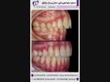 درمان ارتودنسی فکی - دندانی و یک چالش | دکتر فاضل فیروزی 