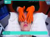 آموزش پاکسازی و جوانسازی پوست | پاکسازی صورت ( مراحل انجام درمارولینگ )