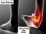 درمان درد مچ پا