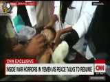 گزارش CNN از وضعیت وحشتناک کودکان در یمن