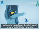 انیمیشن انجام جراحی تغییر جنسیت در ایران 