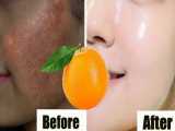 کرم سفید کننده و ضد پیری پوست کرم پرتقال - لکه های تیره را روشن کنید