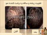 درمان کامل و بدون بازگشت ریزش مو و رویش مجدد مو کاملا گیاهی