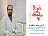 دکتر محمد عاطفت | متخصص دندانپزشکی زیبایی و کاشت دندان در اصفهان