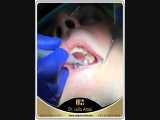 دندانپزشکی کم هزینه=دندانپزشکی پیشگیرانه | دکتر لیلا عطایی 