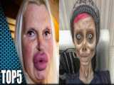 سحر تبر جز 5 چهره ترسناک جهان در اثر جراحی پلاستیک