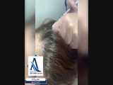 فیلم جلوگیری از ریزش مو با مزوتراپی 