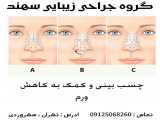 چسب بینی و مراقبت های لازم پس از عمل بینی (گروه جراحی زیبایی سهند)