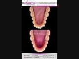 درمان ارتودنسی ثابت | کلینیک تخصصی دندانپزشکی کانسپتا 
