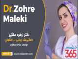 دندانپزشکی زیبایی در اصفهان با استفاده از تکنولوژی دیجیتال | دکتر زهره ملکی