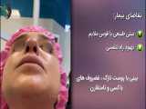 جراحی بینی طبیعی در بیمار با پوست بینی نازک | کتر باستانی نژاد