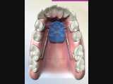 دیستال جت | کلینیک تخصصی دندانپزشکی کانسپتا 