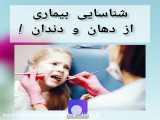 شناسایی بیماری از دهان و دندان