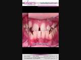 درمان ارتودنسی متحرک و ثابت | کلینیک تخصصی دندانپزشکی کانسپتا 