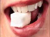 کرم خوردگی دندان چیست؟ راه های جلوگیری از پوسیدگی