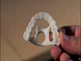 پرینتر سه بعدی دندان NextDent 5100